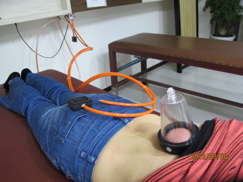 瞬吸可調式吸引力拔罐裝置3-1