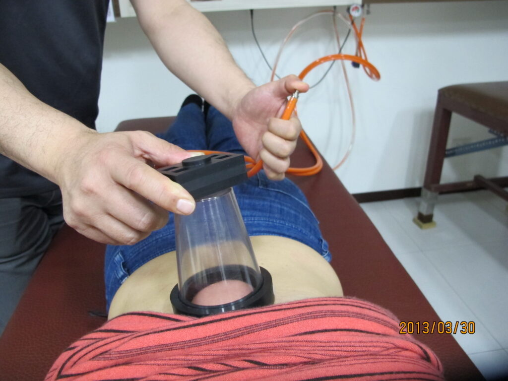 瞬吸可調式吸引力拔罐裝置4-2