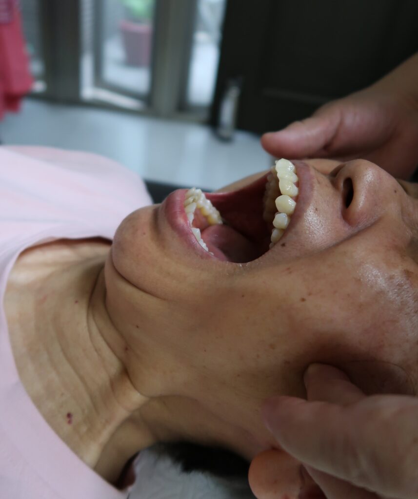 顳顎關節障礙個案報告3