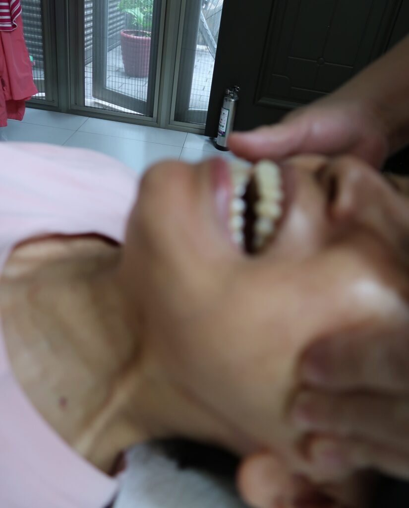 顳顎關節障礙個案報告4