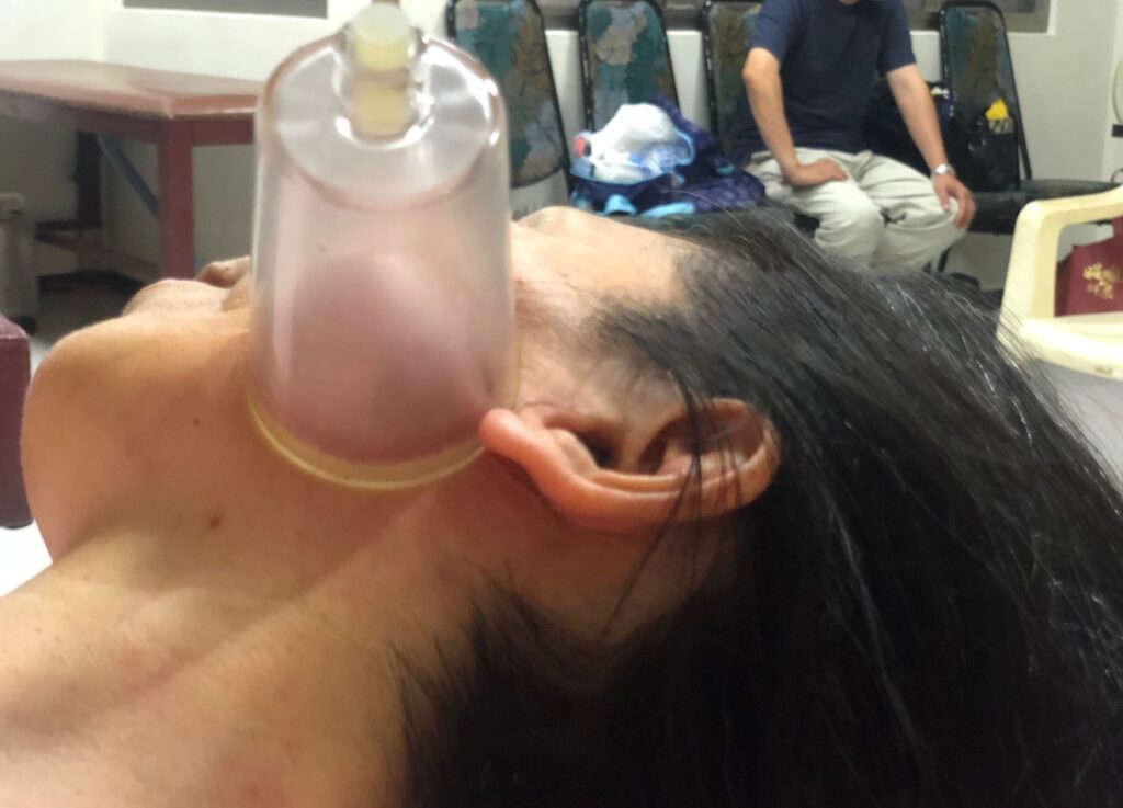 顳顎關節障礙個案報告7