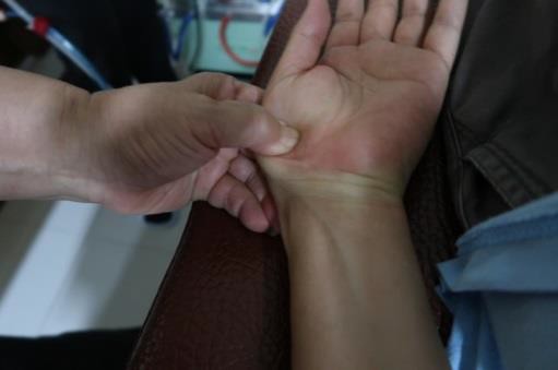 大姆指手機症候群1