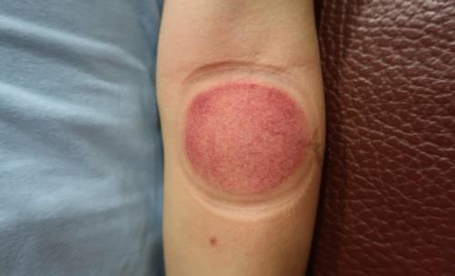 大姆指手機症候群6