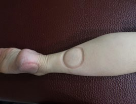 足踝損傷疼痛1-4