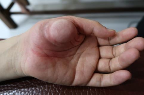 大姆指手機症候群4