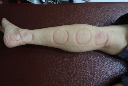 足踝損傷疼痛2-1