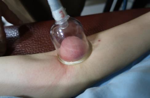 大姆指手機症候群5