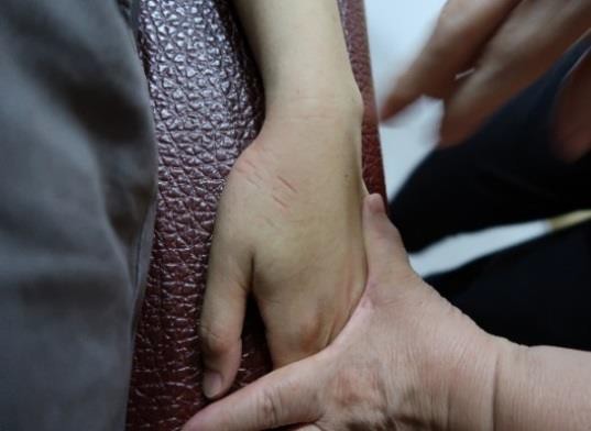 大姆指手機症候群7