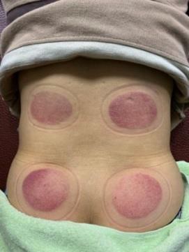 下背痛實例個案報告2