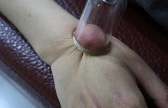 大姆指手機症候群8