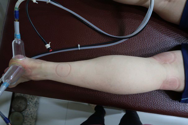 足踝損傷疼痛3-5