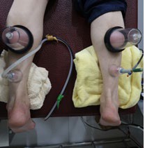 足踝損傷疼痛3-2-5