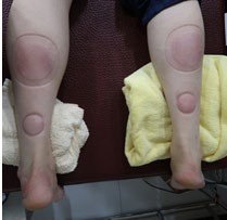 足踝損傷疼痛3-2-6