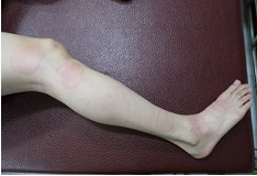 足踝損傷疼痛3-5-1