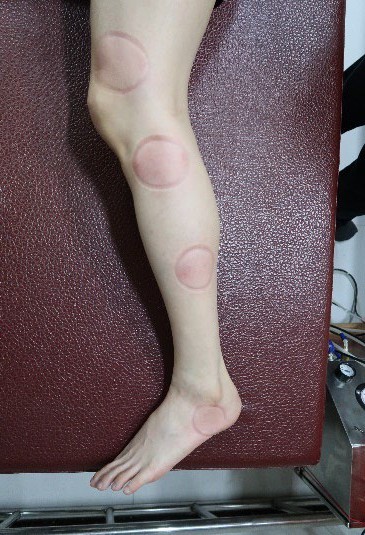 足踝損傷疼痛3-5-2