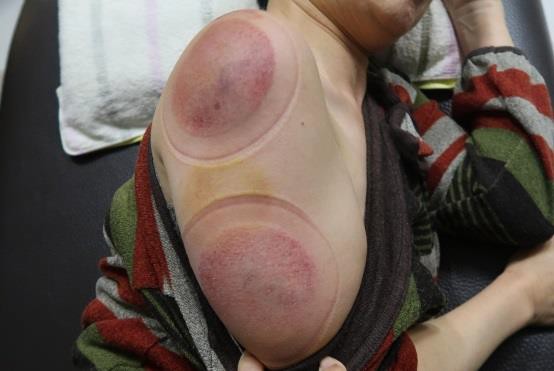 肩臂上肢疼痛圖Ⅲ-1