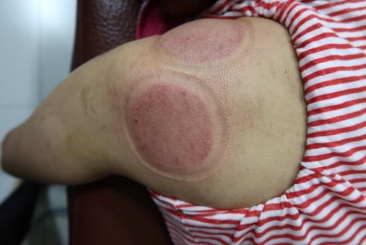 肩臂上肢疼痛圖VI