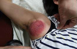 肩臂上肢疼痛圖VII-2