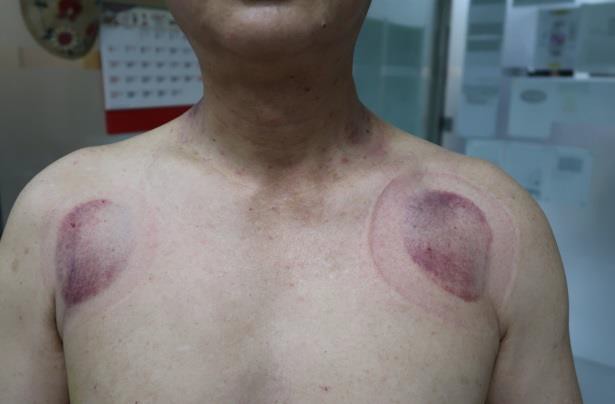 肩臂上肢疼痛圖VIII