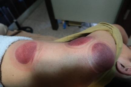 肩臂上肢疼痛圖IX