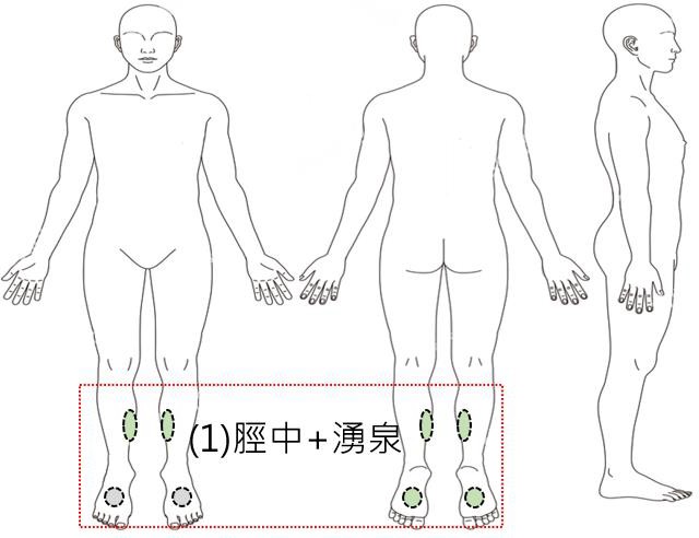 拔罐與氣的導引1