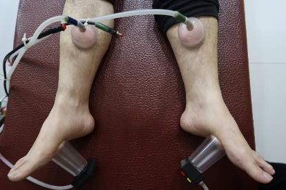 拔罐與氣的導引3