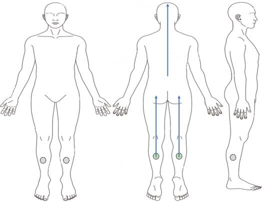 拔罐與氣的導引6