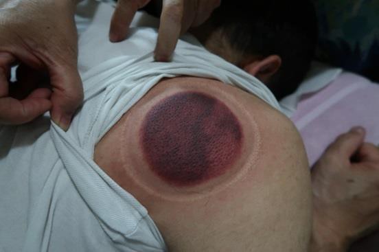 頸部及肩臂脹痛圖IX