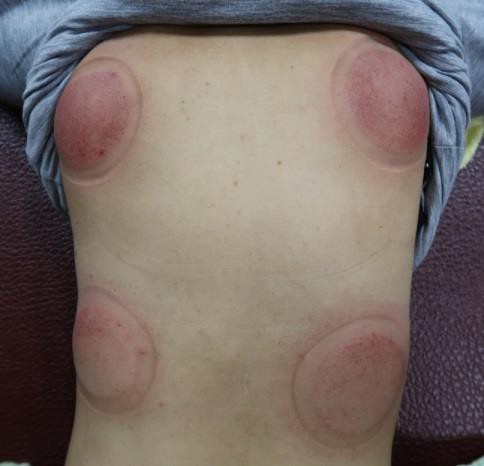 頸部及肩臂脹痛圖XII