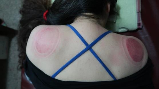 頸部及肩臂脹痛圖XIII