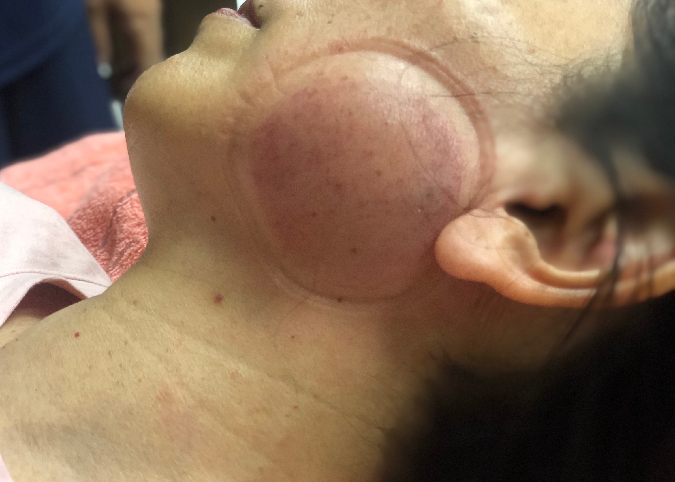 顳顎關節障礙個案報告8